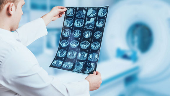 doctor looking mri picture.