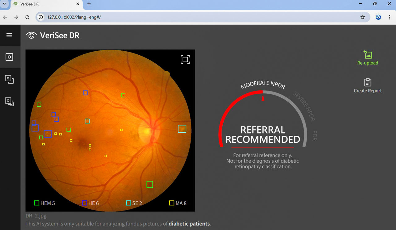 宏碁智醫 VeriSee DR 視網膜病變檢測畫面